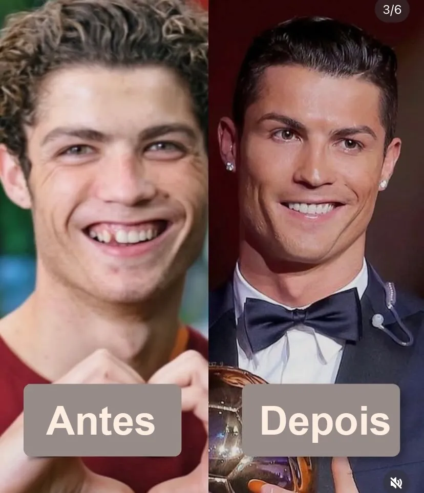 Mesma pessoa antes e depois de ajustar corte e apresentação