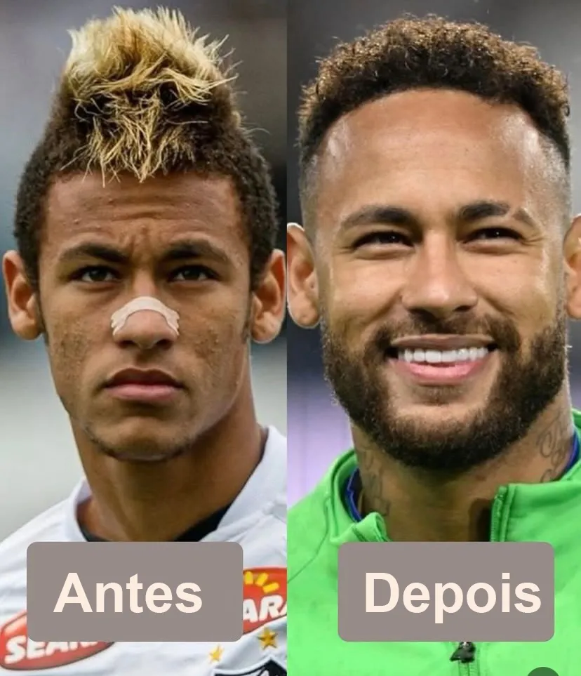 Mesma pessoa antes e depois de ajustar corte e barba